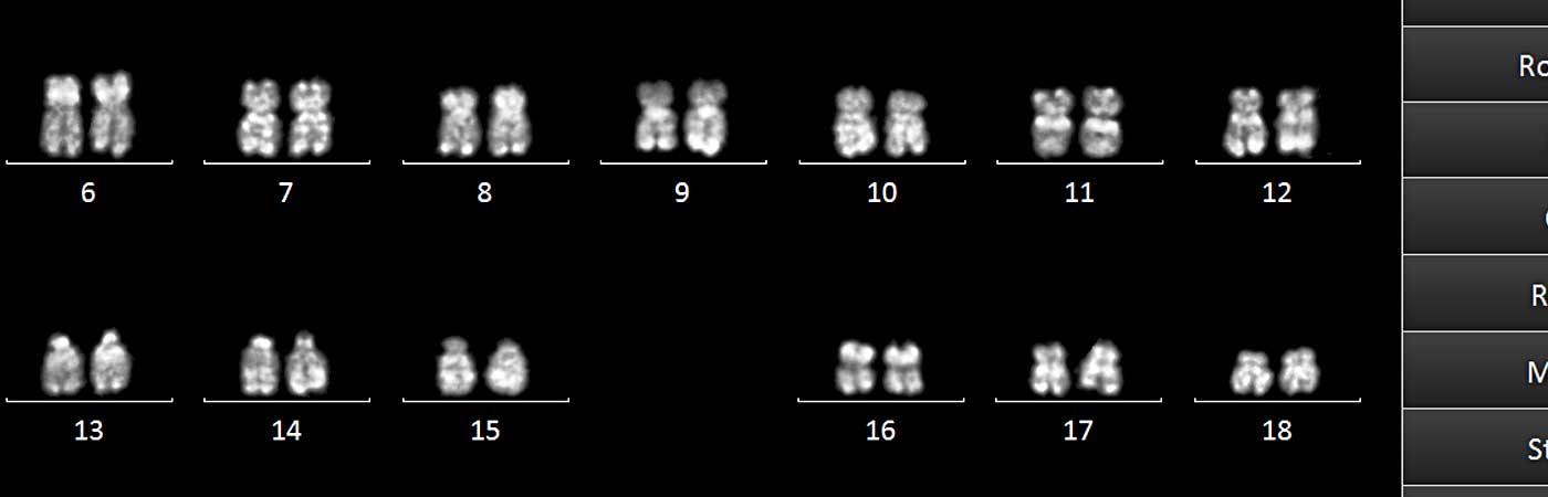 ikaros karyotyping software